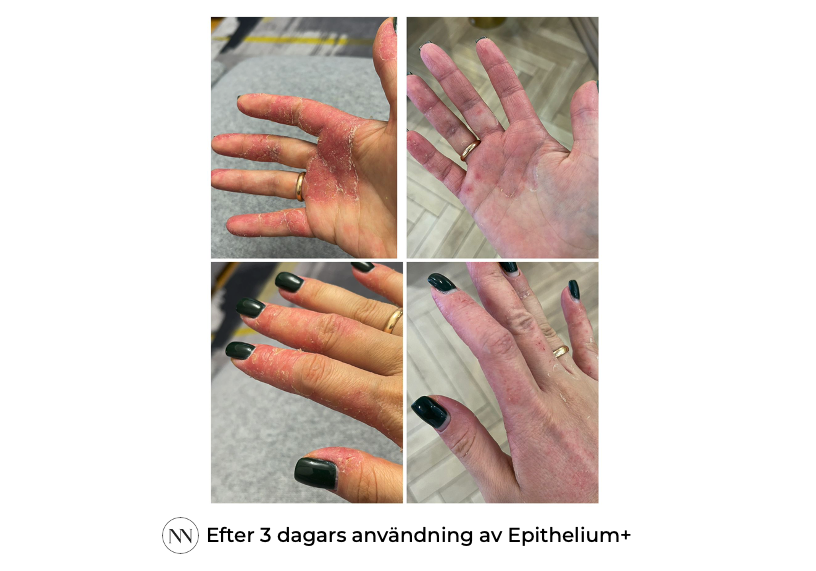 Epithelium+ 3 dagen SE