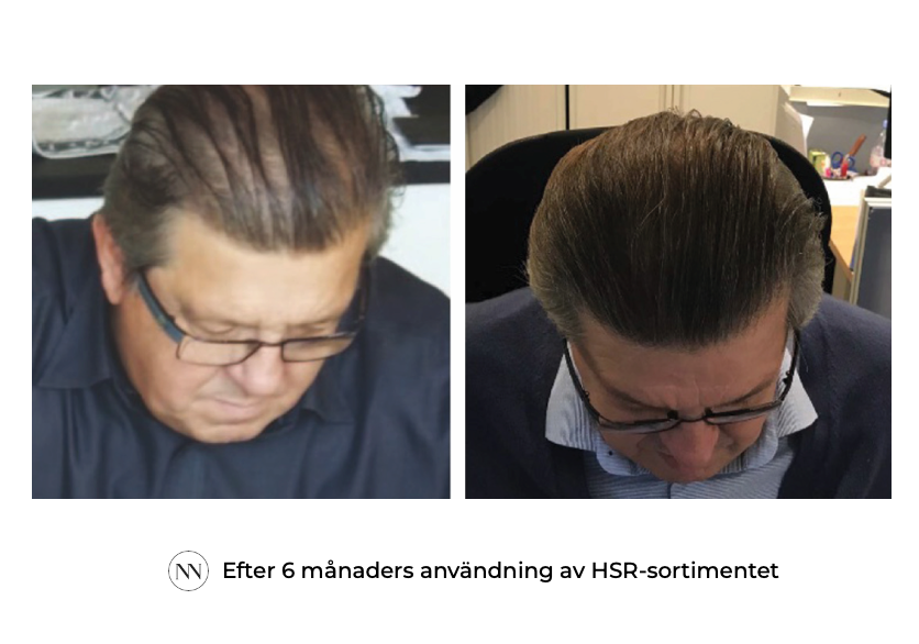 HSR 6 maand SE