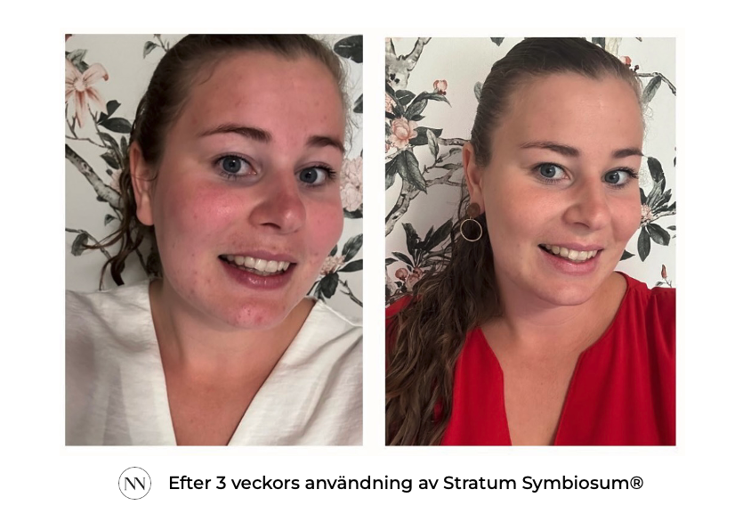 Stratum 3 weken SE