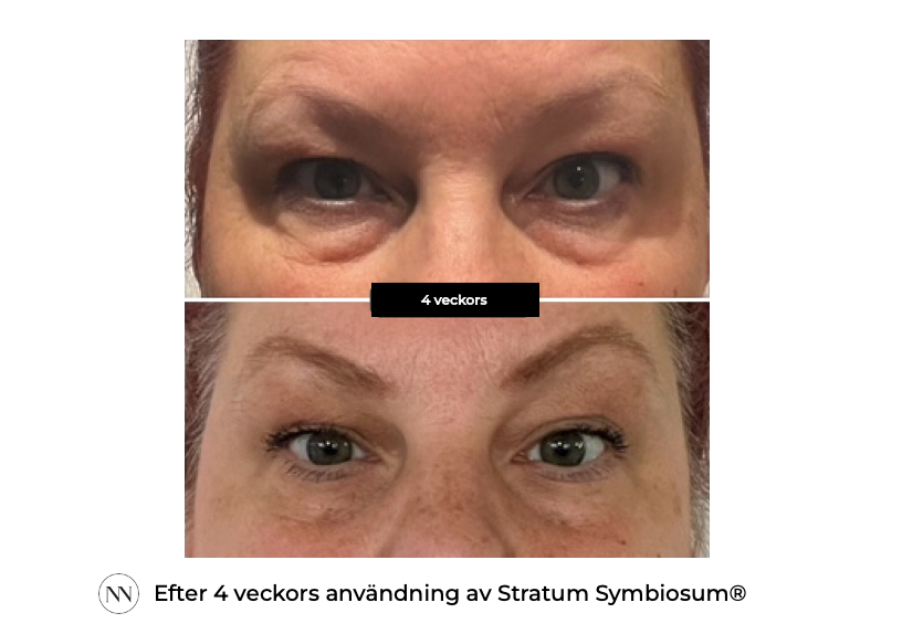 Stratum 4 weeks SE