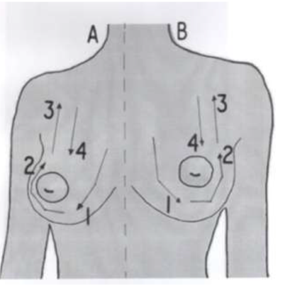 Afbeelding5