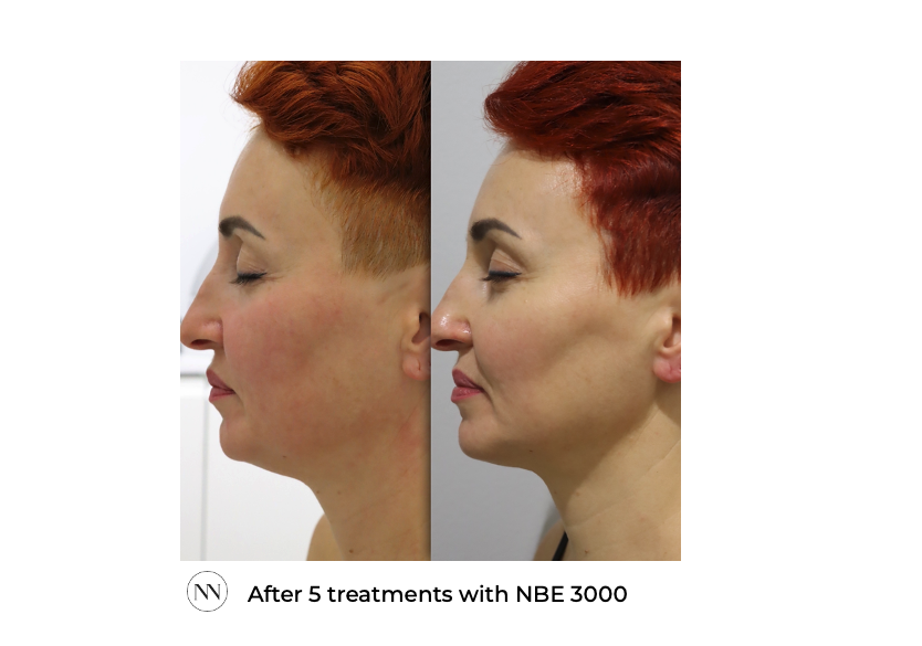 Face 5x NBE ENG