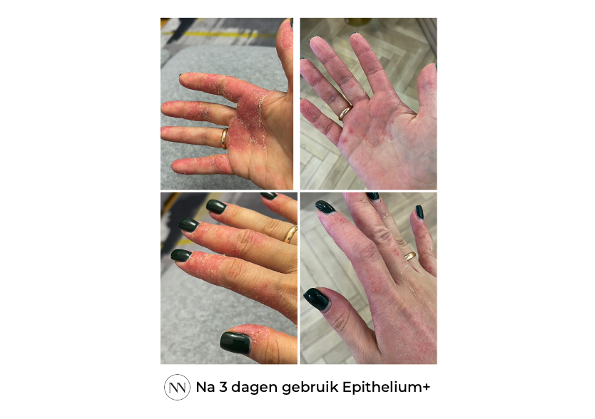 Epithelium+ 3 dagen NL