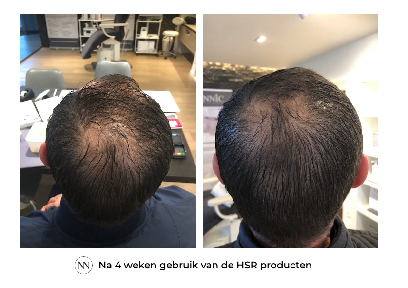 HSR 4 weken NL