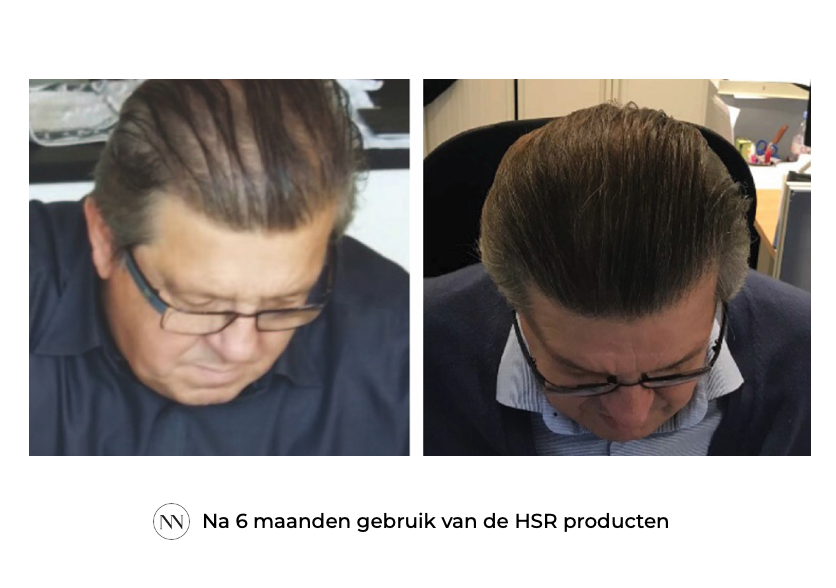 HSR 6 maand NL