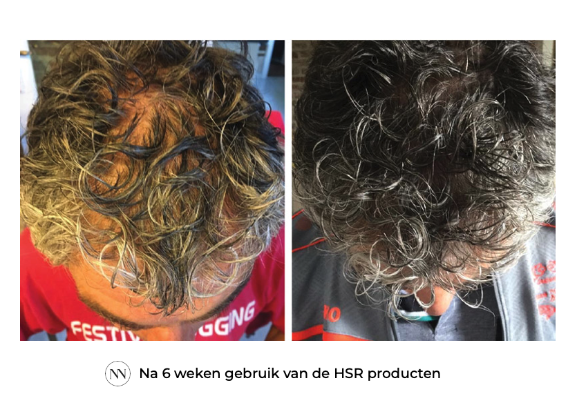 HSR 6 weken NL
