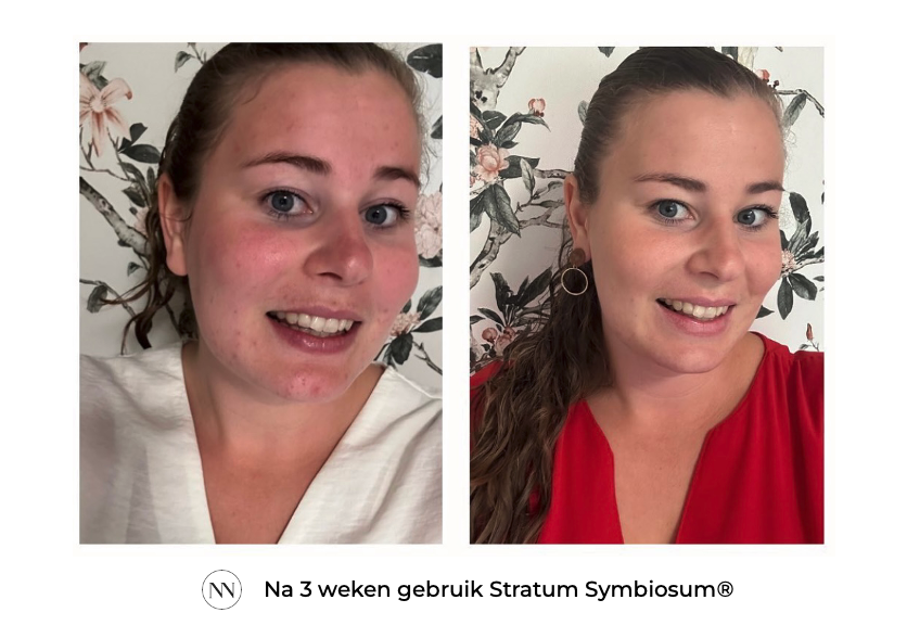 Stratum 3 weken NL