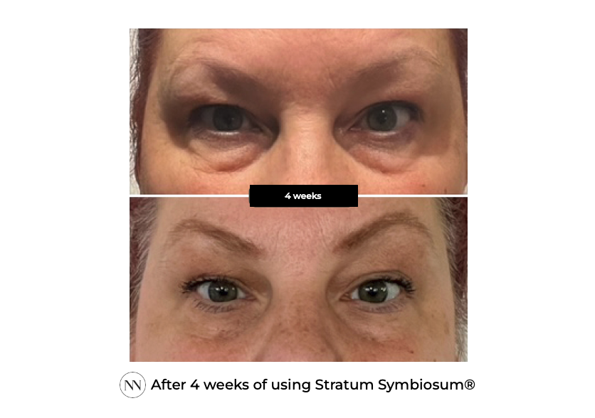 Stratum 4 weeks ENG